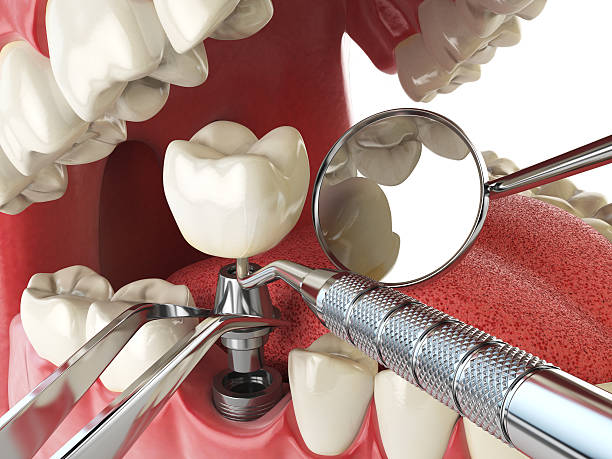 Fast & Reliable Emergency Dental Services in TX